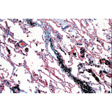 Air Pollution and Allergens - English Slides