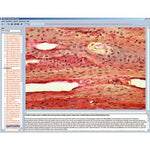 Human skeleton, musculature and apparatus of movement, Interactive CD-ROM