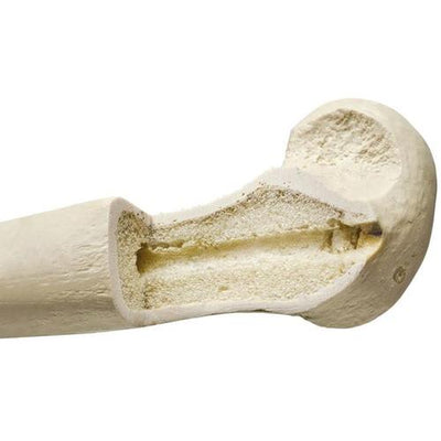 ORTHObones Premium Left Radius