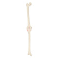 RTHObones Premium Left Knee
