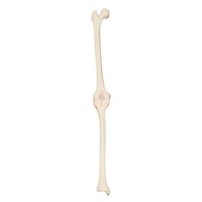 RTHObones Premium Left Knee