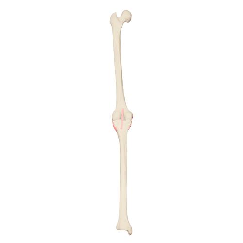 RTHObones Premium Left Knee