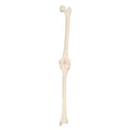 ORTHObones Premium Right knee