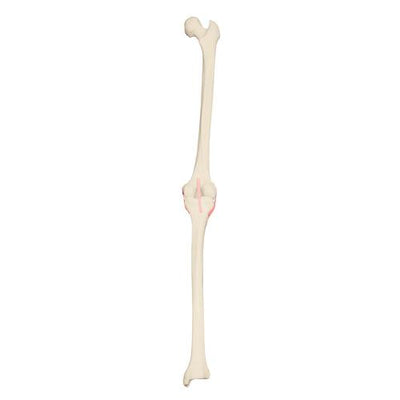 ORTHObones Premium Right knee