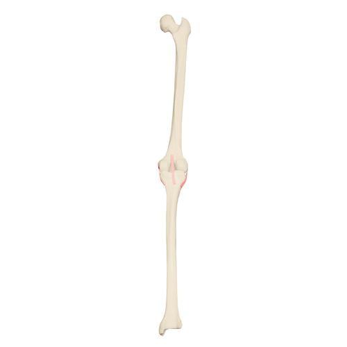 ORTHObones Premium Right knee
