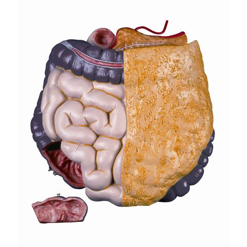 Spare intestine package, 2 parts, complete