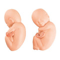 Replacement fetuses for twin fetus model in the fifth month