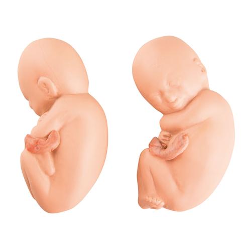 Replacement fetuses for twin fetus model in the fifth month