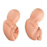 Replacement fetuses for twin fetus model in the fifth month